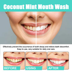 Oral Care For Teeth Whitening, Refreshing, And Refreshing Mouthwash - Blondies Flips Gear and Clothing