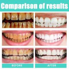 Oral Care For Teeth Whitening, Refreshing, And Refreshing Mouthwash - Blondies Flips Gear and Clothing