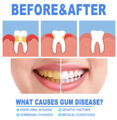 Teeth Repair Gel - Blondies Flips Gear and Clothing